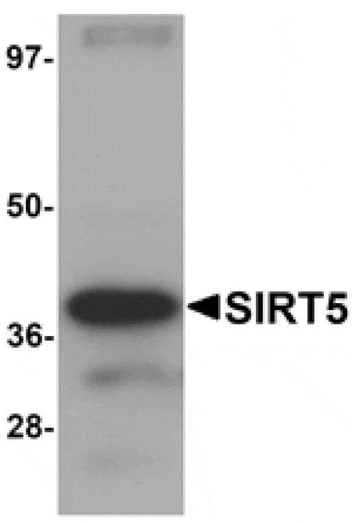 Western blot - SIRT5 Antibody from Signalway Antibody (25125) - Antibodies.com