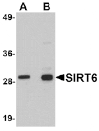 Western blot - SIRT6 Antibody from Signalway Antibody (25126) - Antibodies.com
