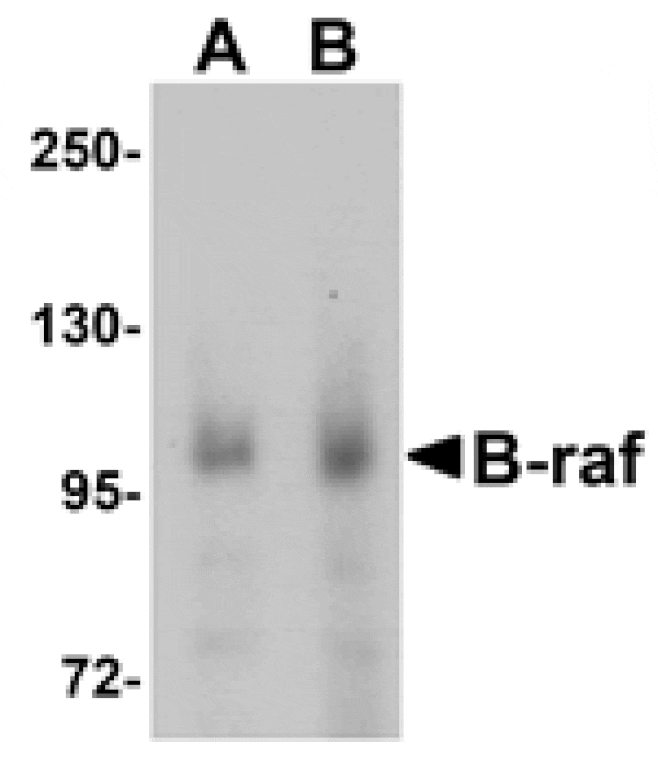 Western blot - B-raf Antibody from Signalway Antibody (25128) - Antibodies.com