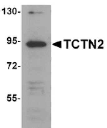 Western blot - TCTN2 Antibody from Signalway Antibody (25149) - Antibodies.com