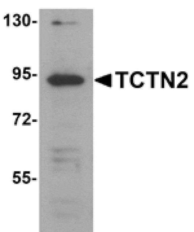 Western blot - TCTN2 Antibody from Signalway Antibody (25149) - Antibodies.com