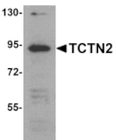 Western blot - TCTN2 Antibody from Signalway Antibody (25149) - Antibodies.com