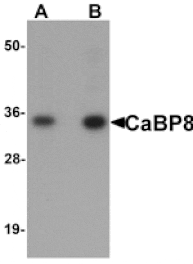 Western blot - CaBP8 Antibody from Signalway Antibody (25160) - Antibodies.com