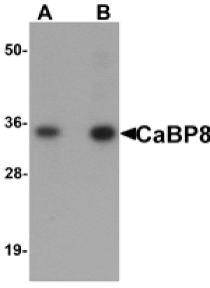 Western blot - CaBP8 Antibody from Signalway Antibody (25160) - Antibodies.com