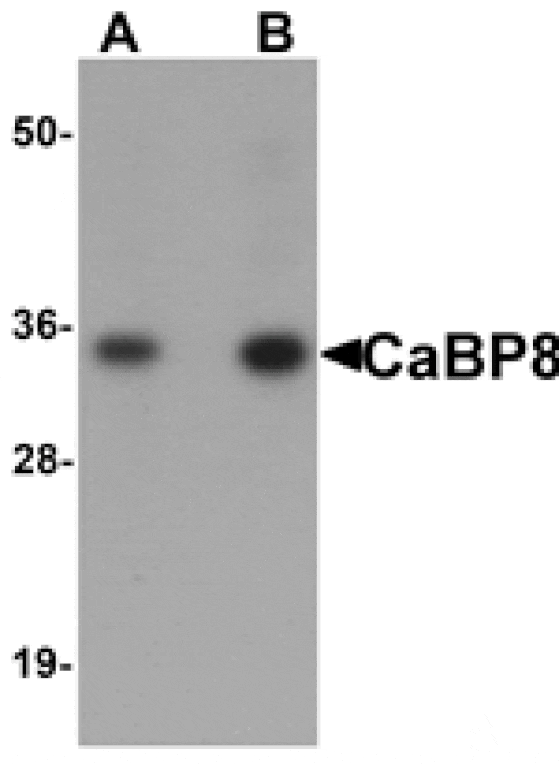 Western blot - CaBP8 Antibody from Signalway Antibody (25160) - Antibodies.com
