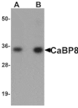 Western blot - CaBP8 Antibody from Signalway Antibody (25160) - Antibodies.com