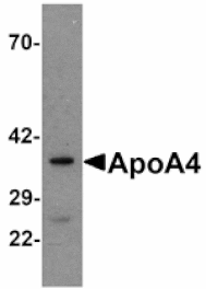 Western blot - ApoA4 Antibody from Signalway Antibody (25173) - Antibodies.com