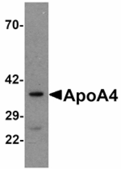 Western blot - ApoA4 Antibody from Signalway Antibody (25173) - Antibodies.com