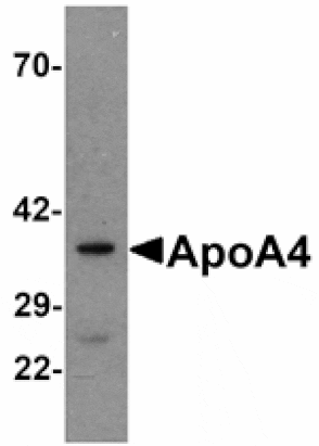 Western blot - ApoA4 Antibody from Signalway Antibody (25173) - Antibodies.com