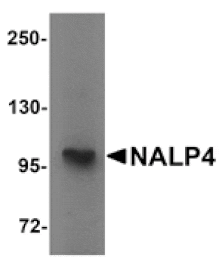 Western blot - NALP4 Antibody from Signalway Antibody (25179) - Antibodies.com