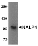 Western blot - NALP4 Antibody from Signalway Antibody (25179) - Antibodies.com