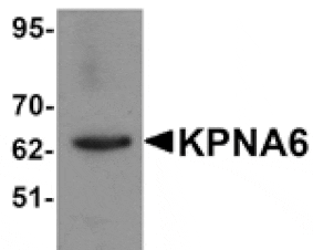 Western blot - KPNA6 Antibody from Signalway Antibody (25195) - Antibodies.com