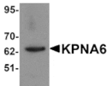 Western blot - KPNA6 Antibody from Signalway Antibody (25195) - Antibodies.com