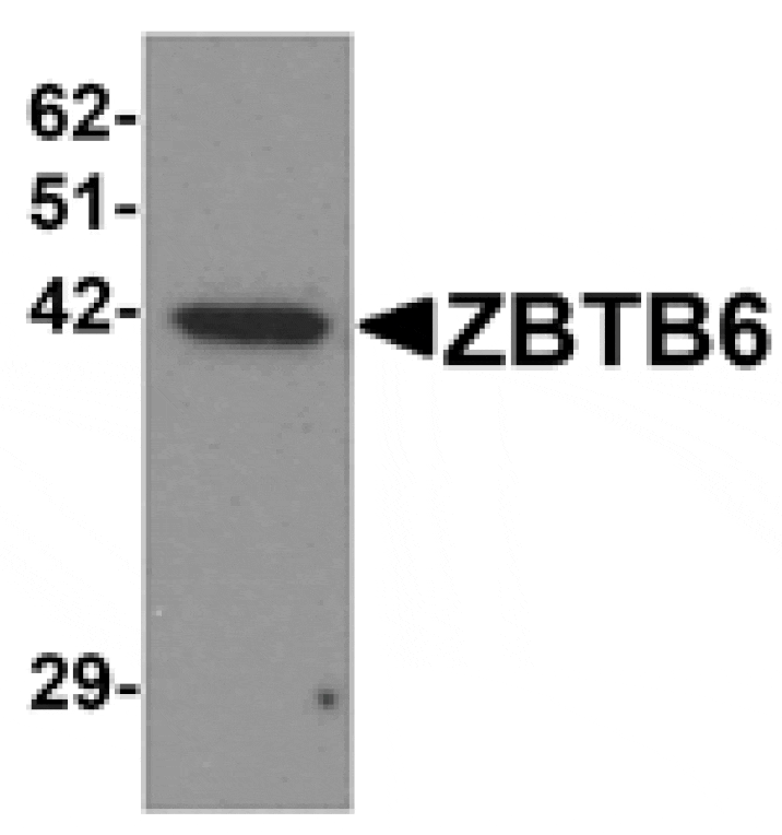 Western blot - ZBTB6 Antibody from Signalway Antibody (25245) - Antibodies.com