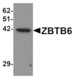 Western blot - ZBTB6 Antibody from Signalway Antibody (25245) - Antibodies.com