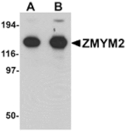 Western blot - ZMYM2 Antibody from Signalway Antibody (25250) - Antibodies.com