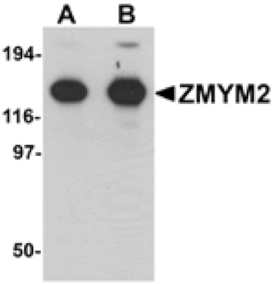 Western blot - ZMYM2 Antibody from Signalway Antibody (25250) - Antibodies.com