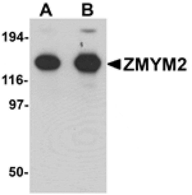 Western blot - ZMYM2 Antibody from Signalway Antibody (25250) - Antibodies.com