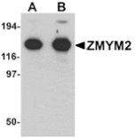Western blot - ZMYM2 Antibody from Signalway Antibody (25250) - Antibodies.com