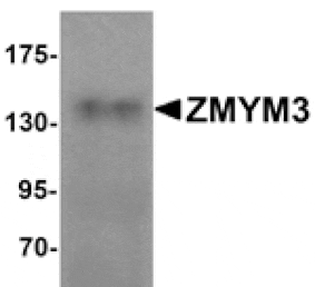 Western blot - ZMYM3 Antibody from Signalway Antibody (25251) - Antibodies.com