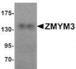 Western blot - ZMYM3 Antibody from Signalway Antibody (25251) - Antibodies.com
