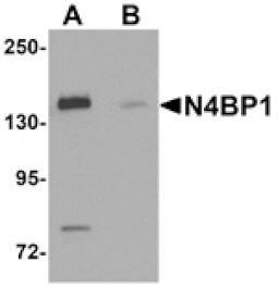 Western blot - N4BP1 Antibody from Signalway Antibody (25259) - Antibodies.com