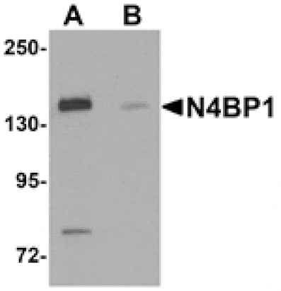 Western blot - N4BP1 Antibody from Signalway Antibody (25259) - Antibodies.com