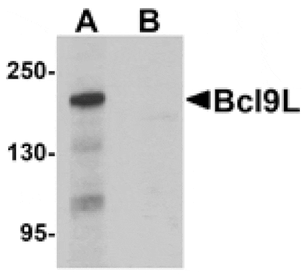 Western blot - Bcl9L Antibody from Signalway Antibody (25270) - Antibodies.com