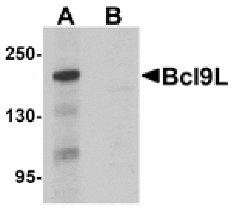 Western blot - Bcl9L Antibody from Signalway Antibody (25270) - Antibodies.com