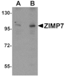 Western blot - ZIMP7 Antibody from Signalway Antibody (25281) - Antibodies.com