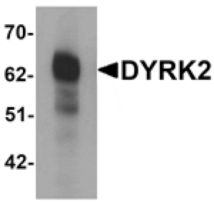 Western blot - DYRK2 Antibody from Signalway Antibody (25289) - Antibodies.com