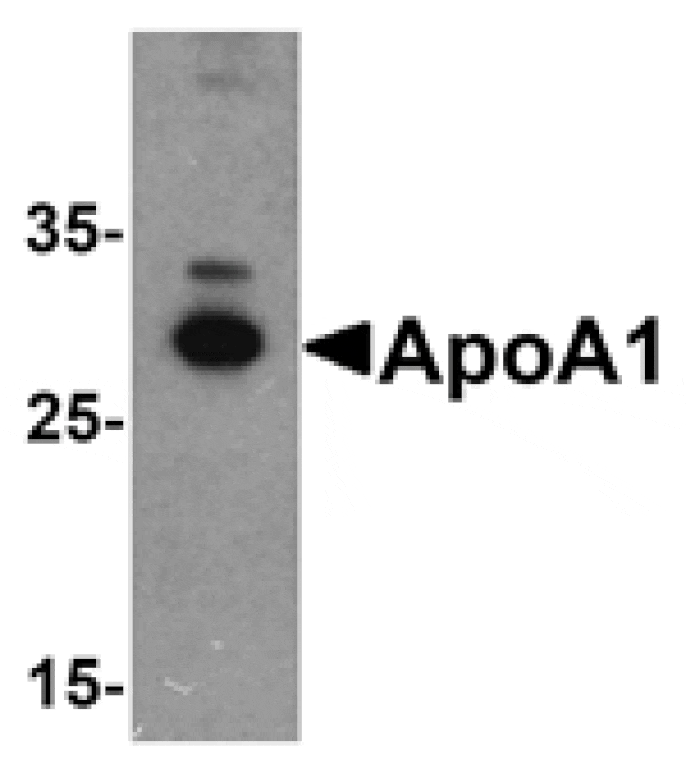 Western blot - ApoA1 Antibody from Signalway Antibody (25292) - Antibodies.com