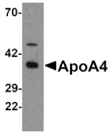 Western blot - ApoA4 Antibody from Signalway Antibody (25293) - Antibodies.com