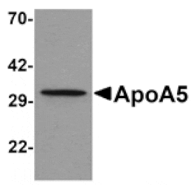Western blot - ApoA5 Antibody from Signalway Antibody (25294) - Antibodies.com