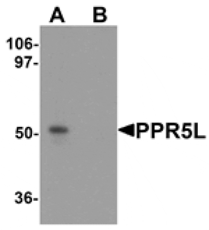 Western blot - PRR5L Antibody from Signalway Antibody (25298) - Antibodies.com