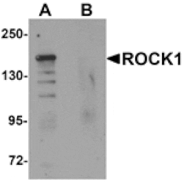 Western blot - ROCK1 Antibody from Signalway Antibody (25299) - Antibodies.com