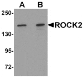 Western blot - ROCK2 Antibody from Signalway Antibody (25300) - Antibodies.com