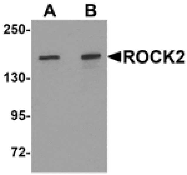 Western blot - ROCK2 Antibody from Signalway Antibody (25300) - Antibodies.com
