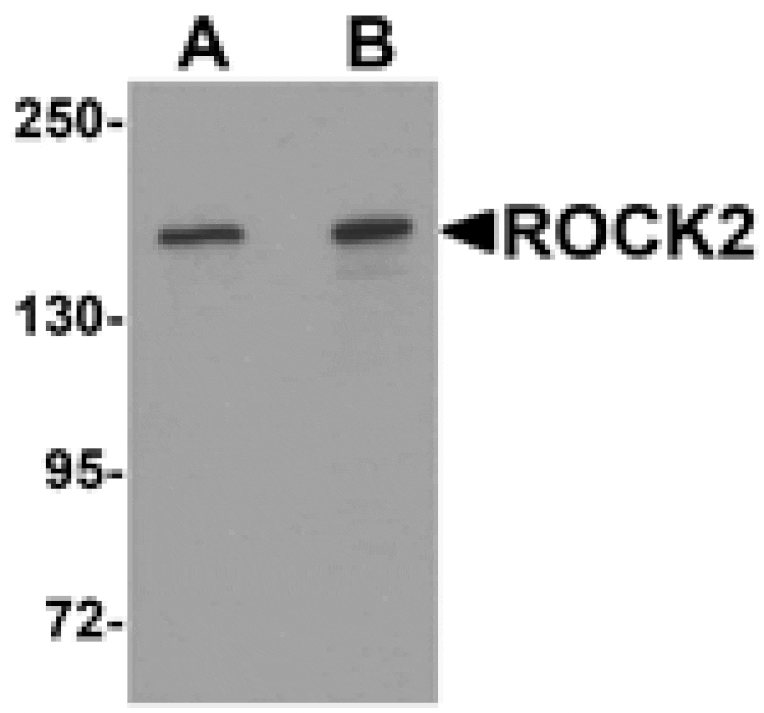Western blot - ROCK2 Antibody from Signalway Antibody (25300) - Antibodies.com