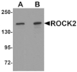 Western blot - ROCK2 Antibody from Signalway Antibody (25300) - Antibodies.com