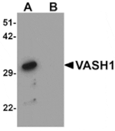 Western blot - VASH1 Antibody from Signalway Antibody (25310) - Antibodies.com