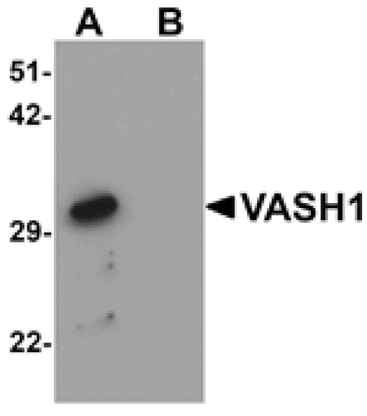 Western blot - VASH1 Antibody from Signalway Antibody (25310) - Antibodies.com