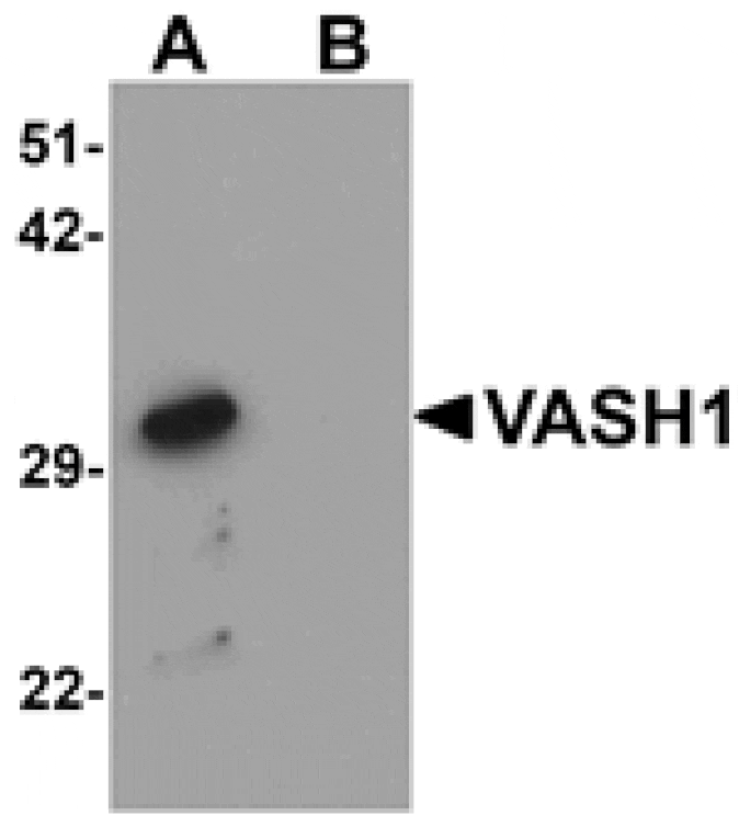 Western blot - VASH1 Antibody from Signalway Antibody (25310) - Antibodies.com
