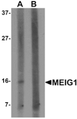 Western blot - MEIG1 Antibody from Signalway Antibody (25318) - Antibodies.com
