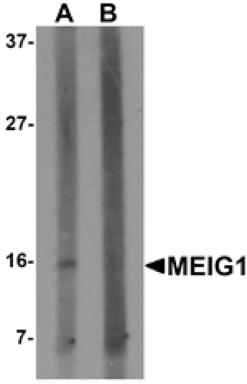Western blot - MEIG1 Antibody from Signalway Antibody (25318) - Antibodies.com