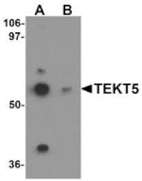 Western blot - TEKT5 Antibody from Signalway Antibody (25319) - Antibodies.com