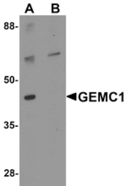 Western blot - GEMC1 Antibody from Signalway Antibody (25320) - Antibodies.com