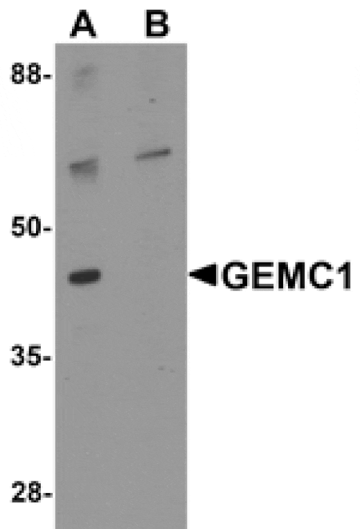 Western blot - GEMC1 Antibody from Signalway Antibody (25320) - Antibodies.com