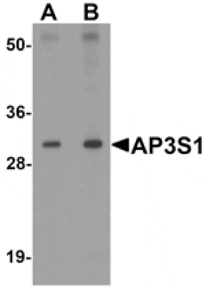 Western blot - AP3S1 Antibody from Signalway Antibody (25323) - Antibodies.com