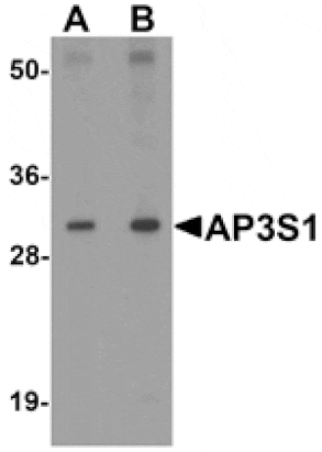 Western blot - AP3S1 Antibody from Signalway Antibody (25323) - Antibodies.com